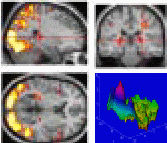 fmri-1.gif (17151 bytes)