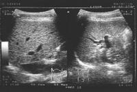 ultrasound.JPG (6411 bytes)